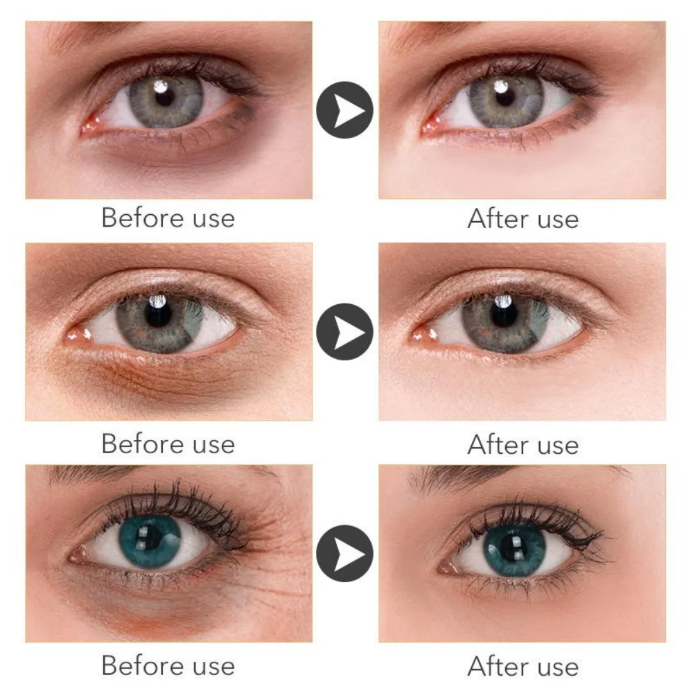 Alternative view of Retinol Anti-aging Whitening Oil Control  Eye Serum Gold Serum Korean Skin Care Products