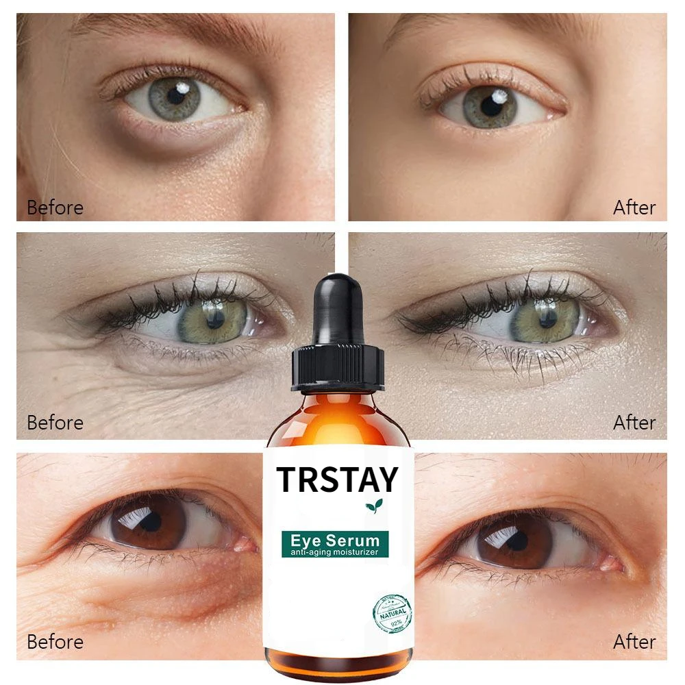 Retinol Anti-aging Whitening Oil Control  Eye Serum Gold Serum Korean Skin Care Products