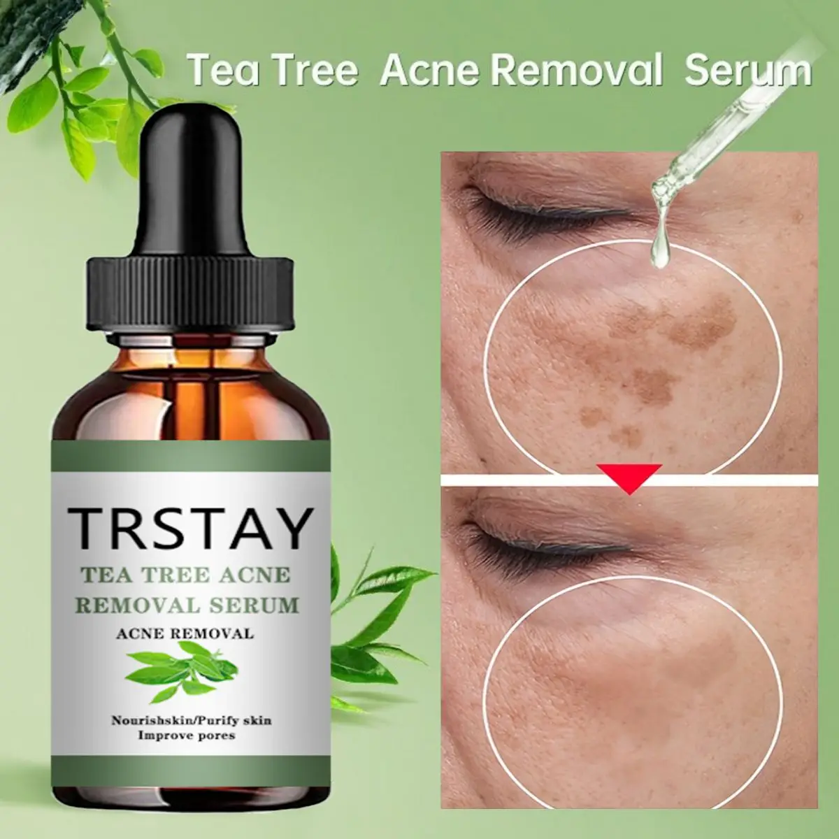 Alternative view of Acne Treatment Face Serum Tea Tree Oil Essence Moisturizing Shrink Pores Acne Facial Serum Korean Skin Care Products