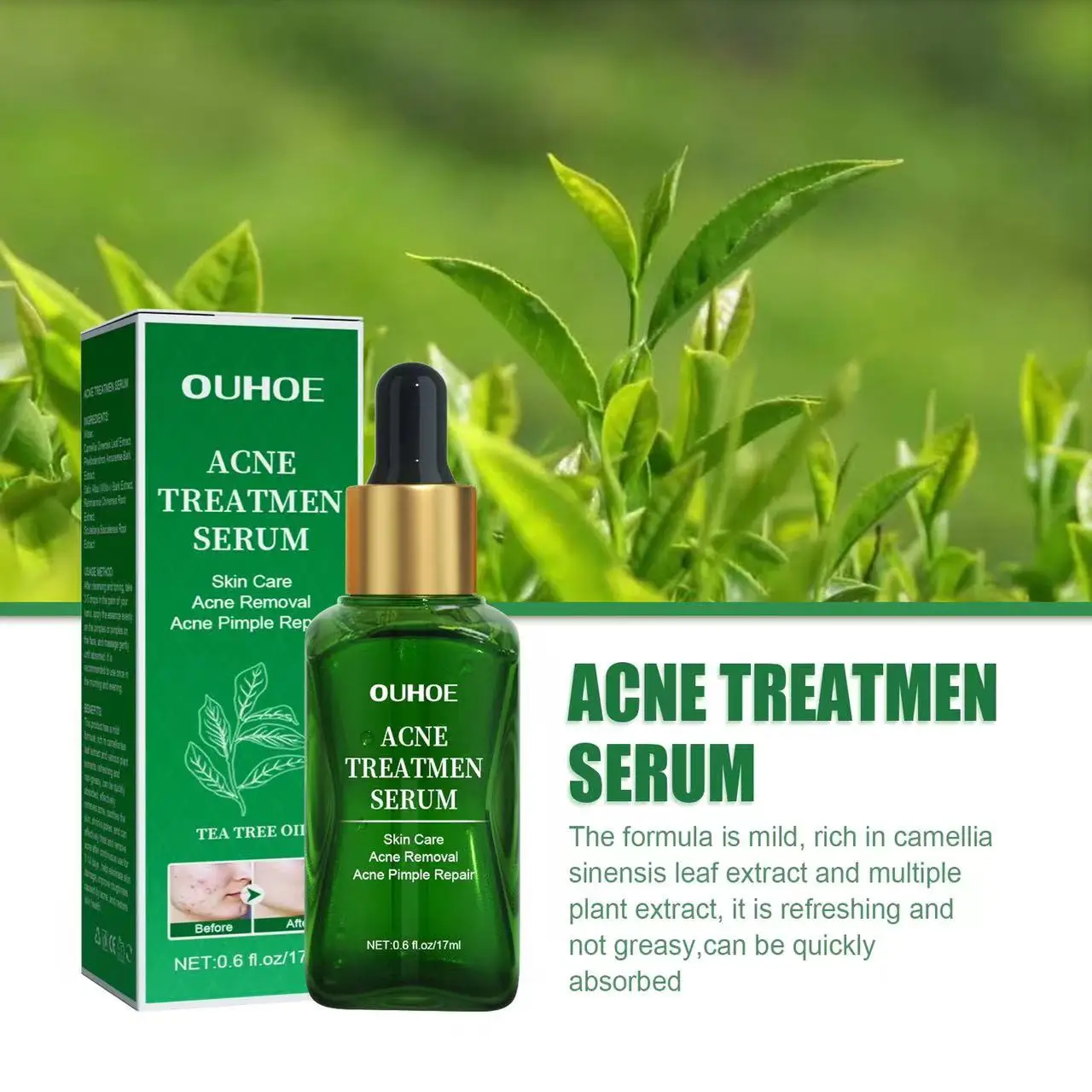 Acne Treatment Facial Serum Pore Shrinking Skin Care Against Face Acne Pimple Spots Remover Cleaning Shrink pores Tea Tree Serum Acne Treatment Facial Serum Pore Shrinking Skin Care Against Face Acne Pimple Spots Remover Cleaning Shrink pores Tea Tree Serum