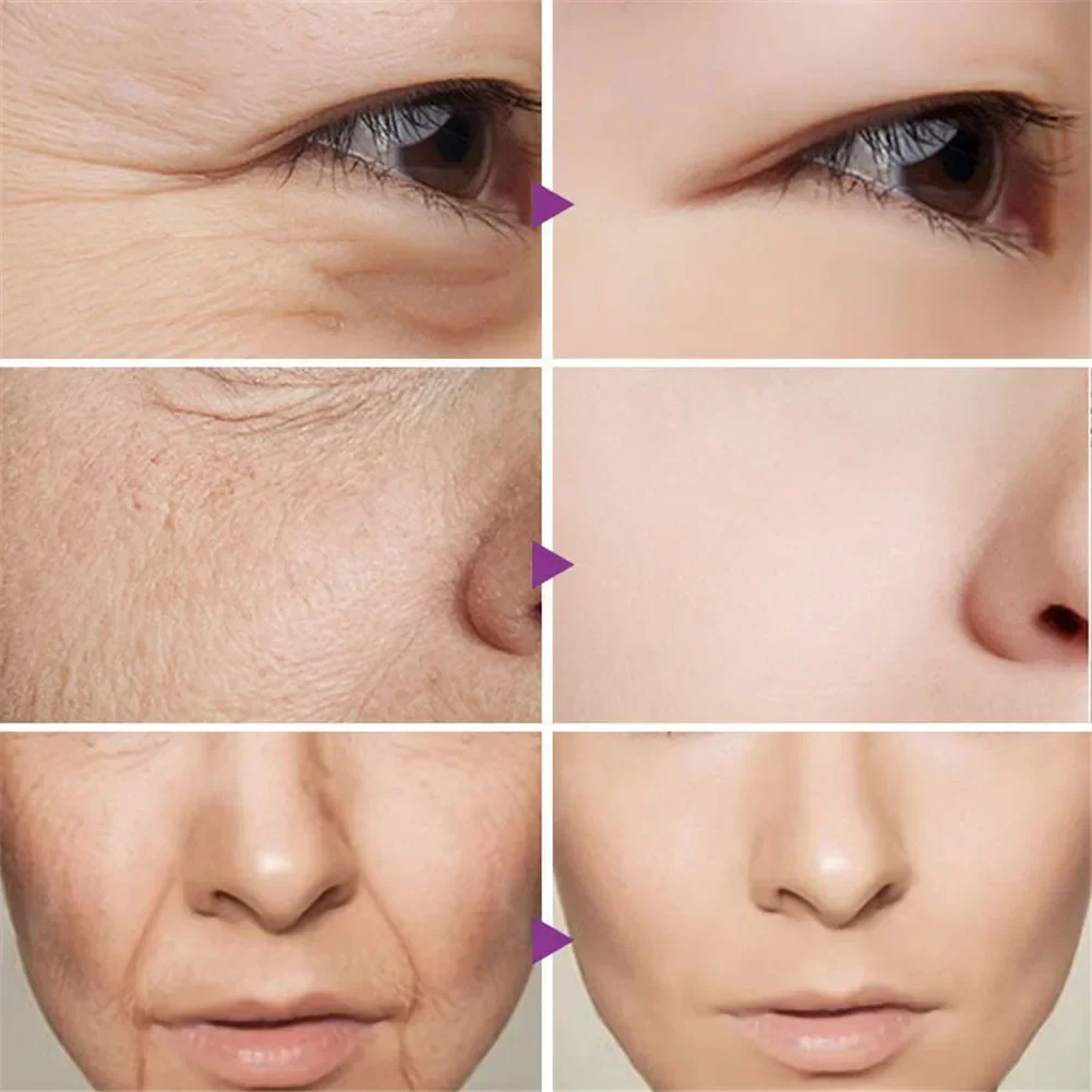 Alternative view of Dragon Blood Cream Wrinkle Removal Facial Serum Rejuvenation Lift Firming Anti-aging Whitening Invisible Pores Beauty Skin Care
