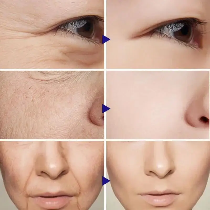 Alternative view of Retinol Wrinkle Remover Face Set Instant Firming Lifting Anti-Aging Serum Fade Fine Lines Whitening Korean Skin Care Products