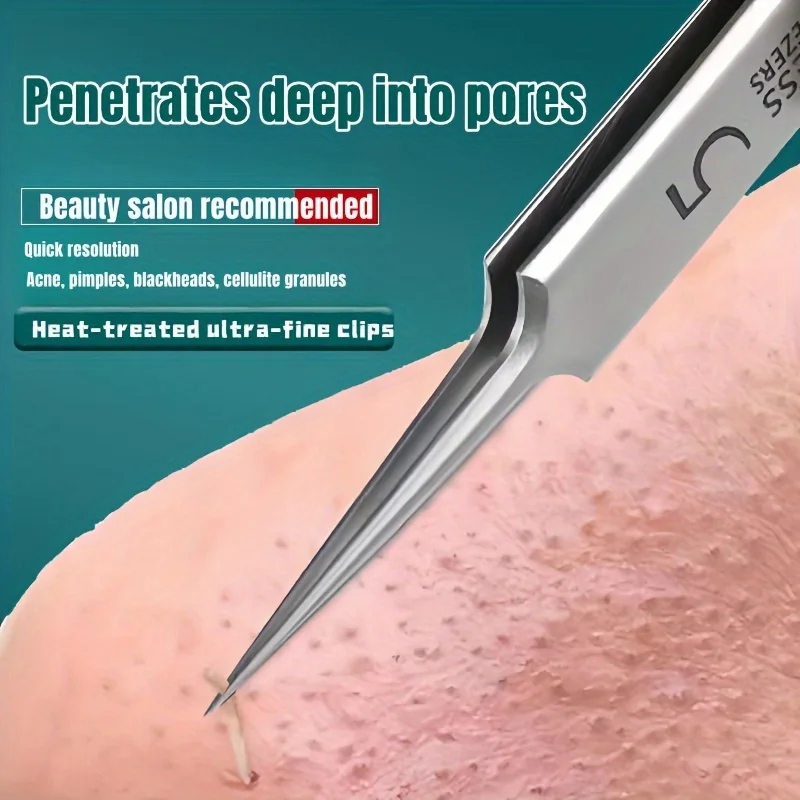 Alternative view of Blackhead Removal Tweezers Stainless Steel Tools - Effective Comedones Extractor, Whiteheads Removal Deep Cleansing Tools