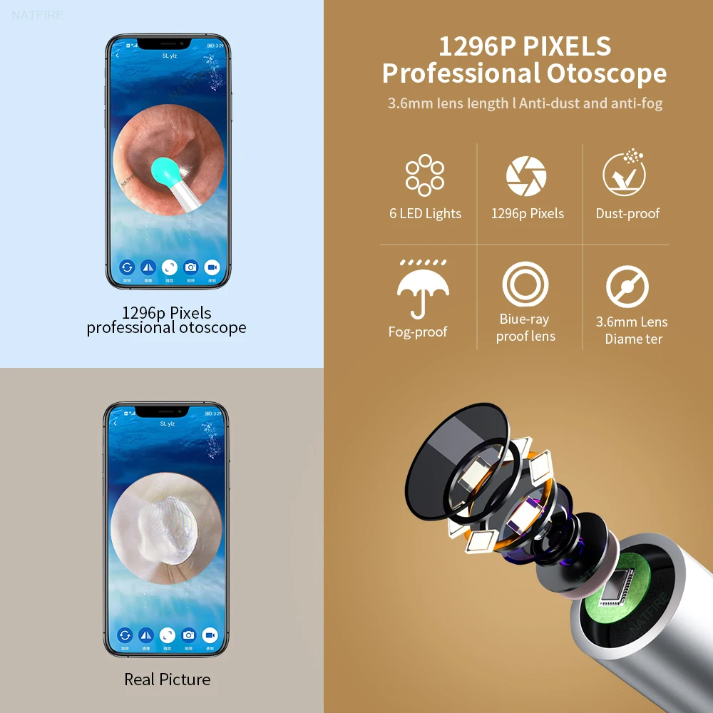 Alternative view of NATFIRE NE7 Smart Visual Ear Sticks Otoscope 1296P Endoscope Wax Removal Tool Earpick Mini Camera Health Care Ear Cleaner